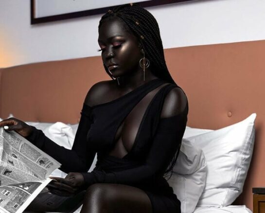 Unique Photos That Show How Unpredictable Genetics Can Be