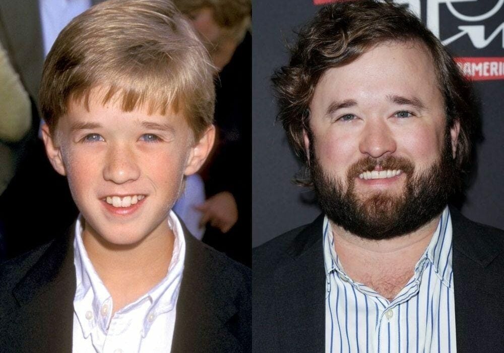 Then And Now: The Biggest Celebrity Transformations