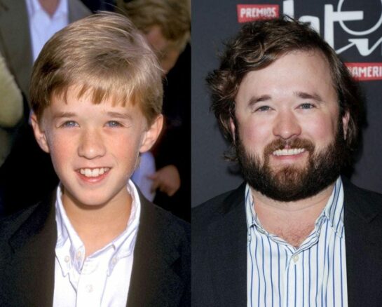 Then And Now: The Biggest Celebrity Transformations