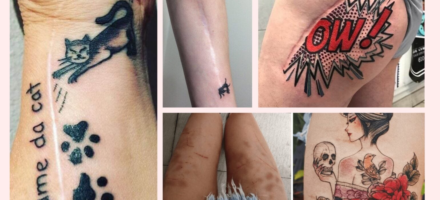 Transforming Scars and Birthmarks into Stunning Works of Art