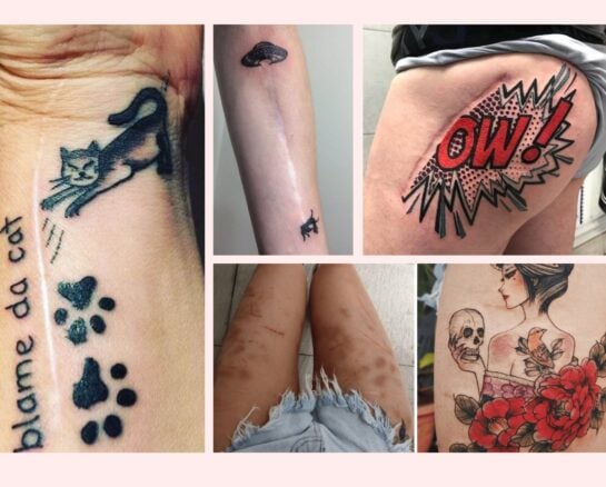 Transforming Scars and Birthmarks into Stunning Works of Art