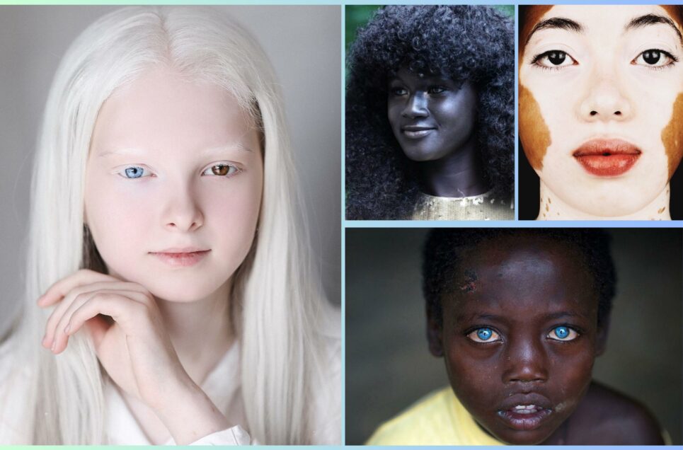 These Fascinating Photos Show the Beauty of Genetic Rarity